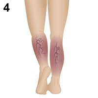 Stage 4 -Chronic Venous Insufficiency